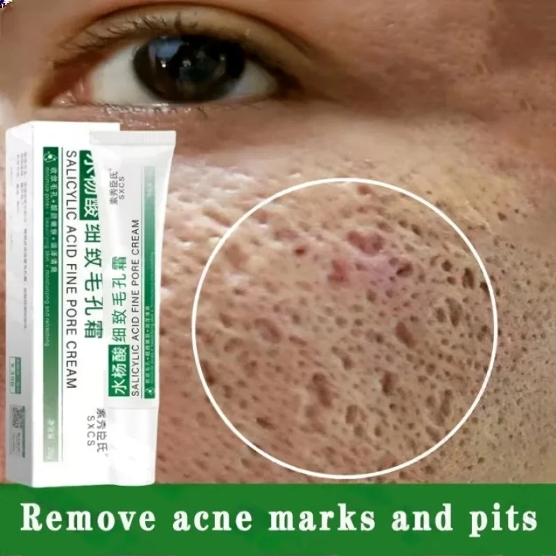 Korean Skincare Routine - Salicylic Acid Pore Clearing Cream รูขุมขนหดตัวลบสิวหัวดําสิว