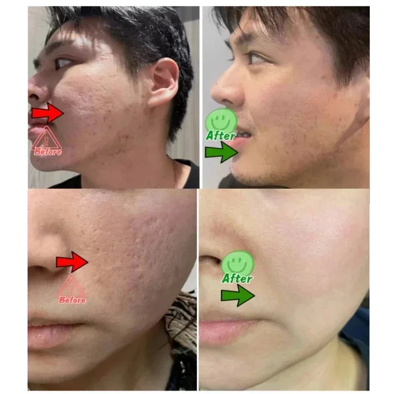 Salicylic Acid Pore Clearing C - Korean Skincare Routine บทวิจารณ์และราคา
