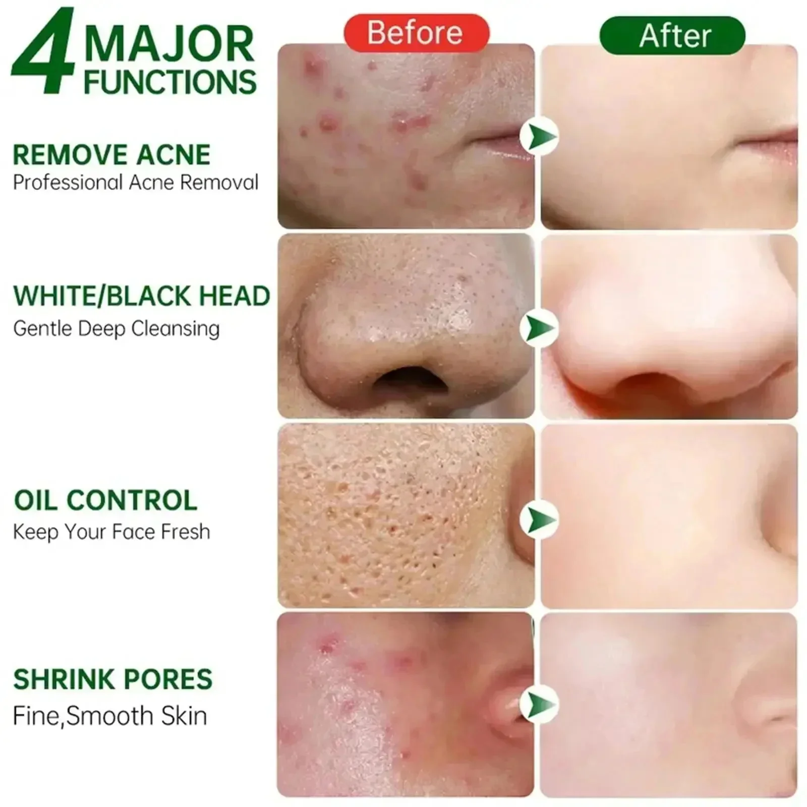 Salicylic Acid Pore Clearing C - Korean Skincare Routine บทวิจารณ์และราคา